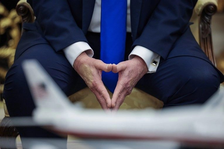 Trumpove modrice na ruci se ponovno skrivaju šminkom